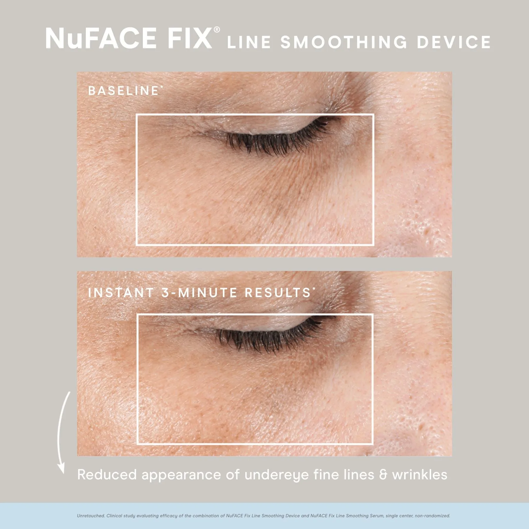 NuFACE FIX KIT