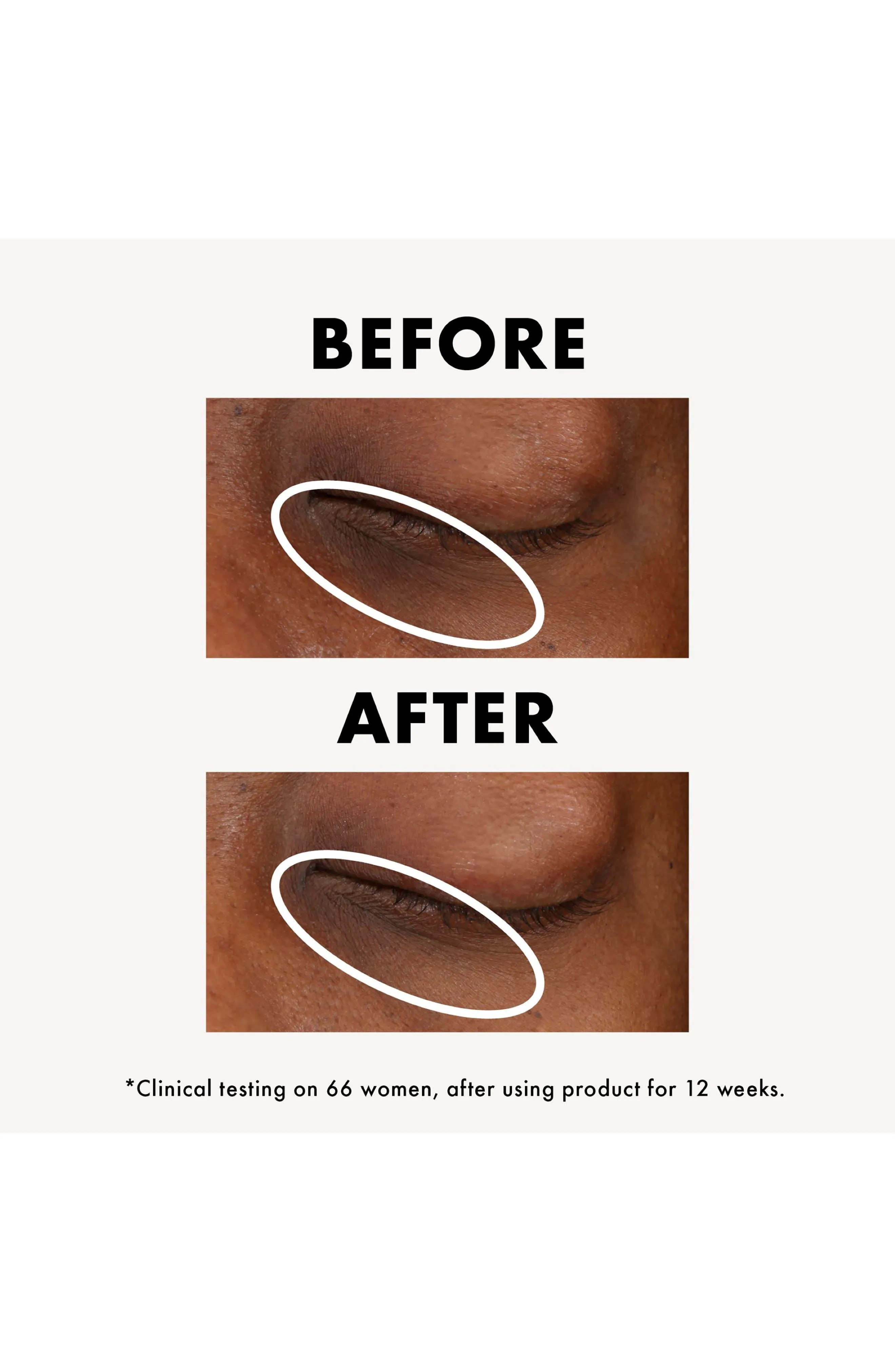 Origins GinZing Vitamin C & Niacinamide Eye Cream To Brighten And Depuff - Original